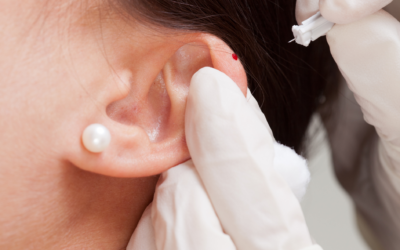 Auricular Therapy