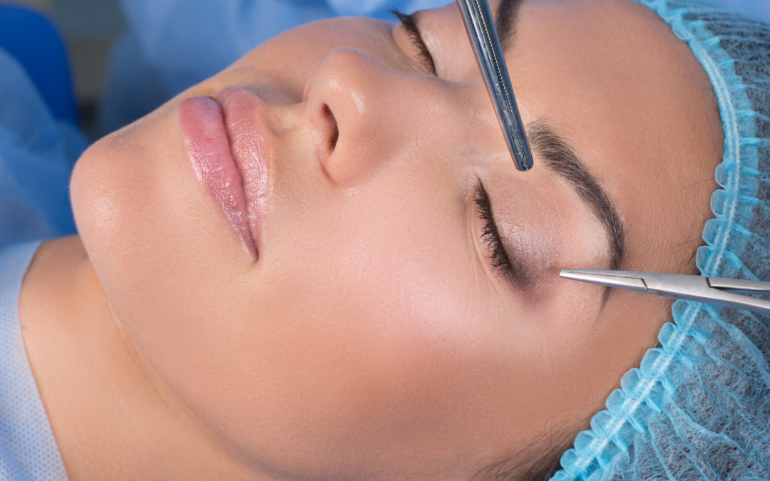 Blepharoplasty