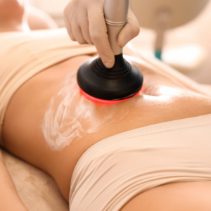 Cellulite Treatment