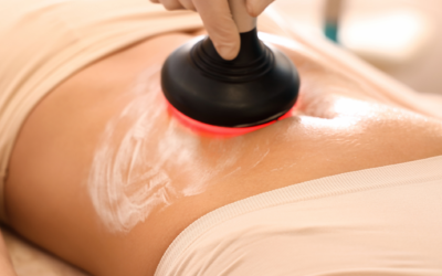 Cellulite Treatment
