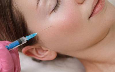 Collagen Fillers