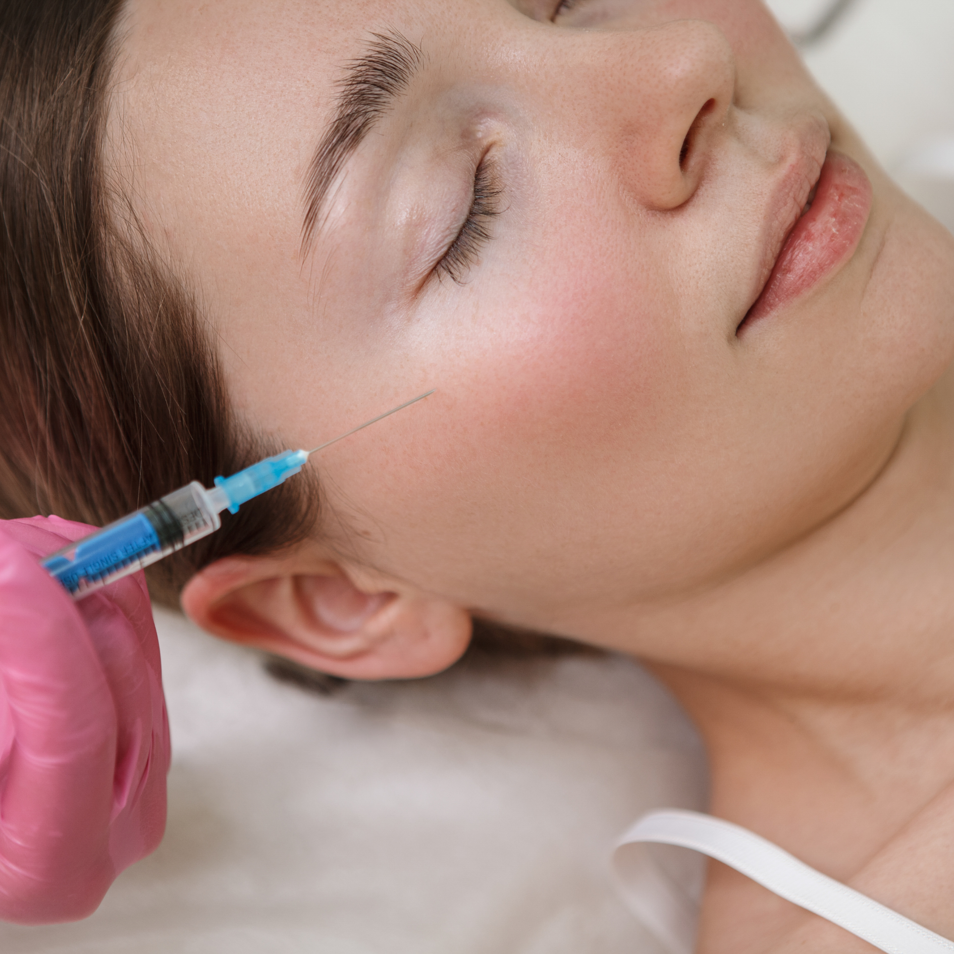 Collagen Fillers