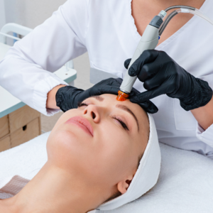Dermabrasion