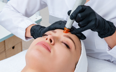 Dermabrasion