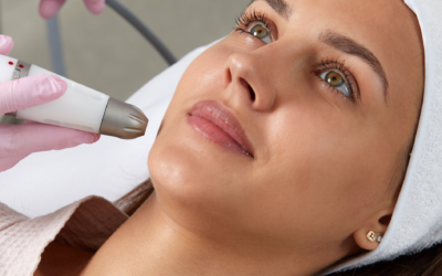 Facetite (radiofrequency)