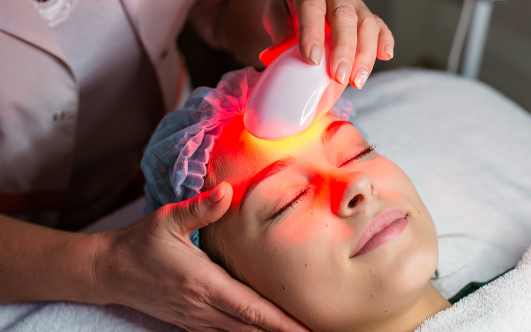 IPL (intense Pulsed Light)