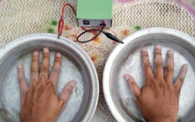 Iontophoresis