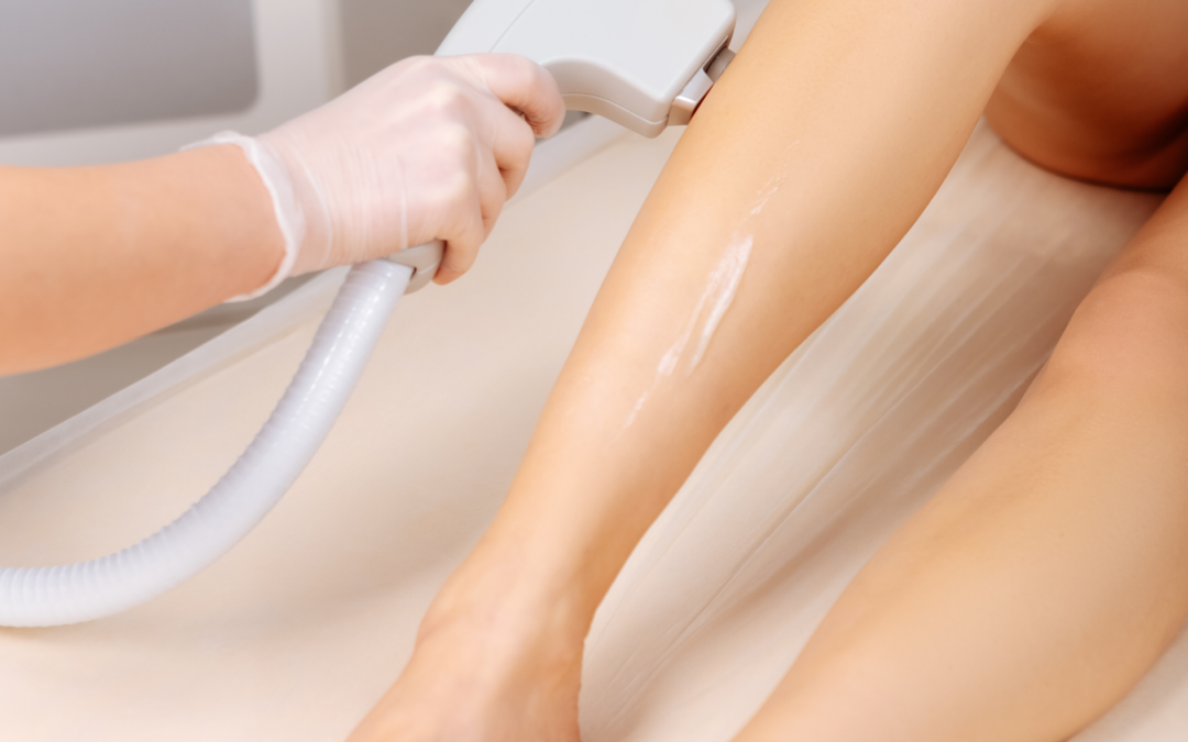 Laser Hair Removal