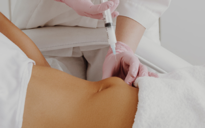 Lipolysis