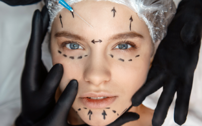Mesotherapy