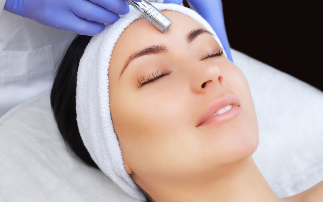 Microdermabrasion