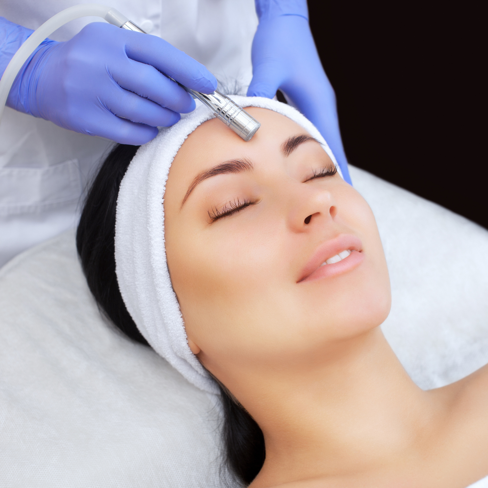 Microdermabrasion