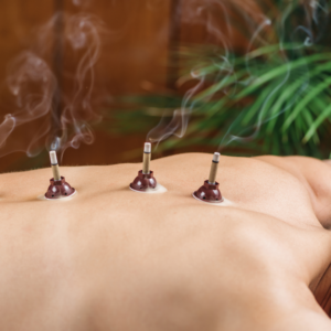Moxibustion