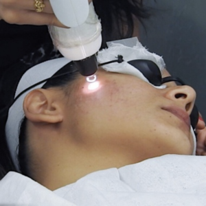 PIGMENTATION REMOVAL