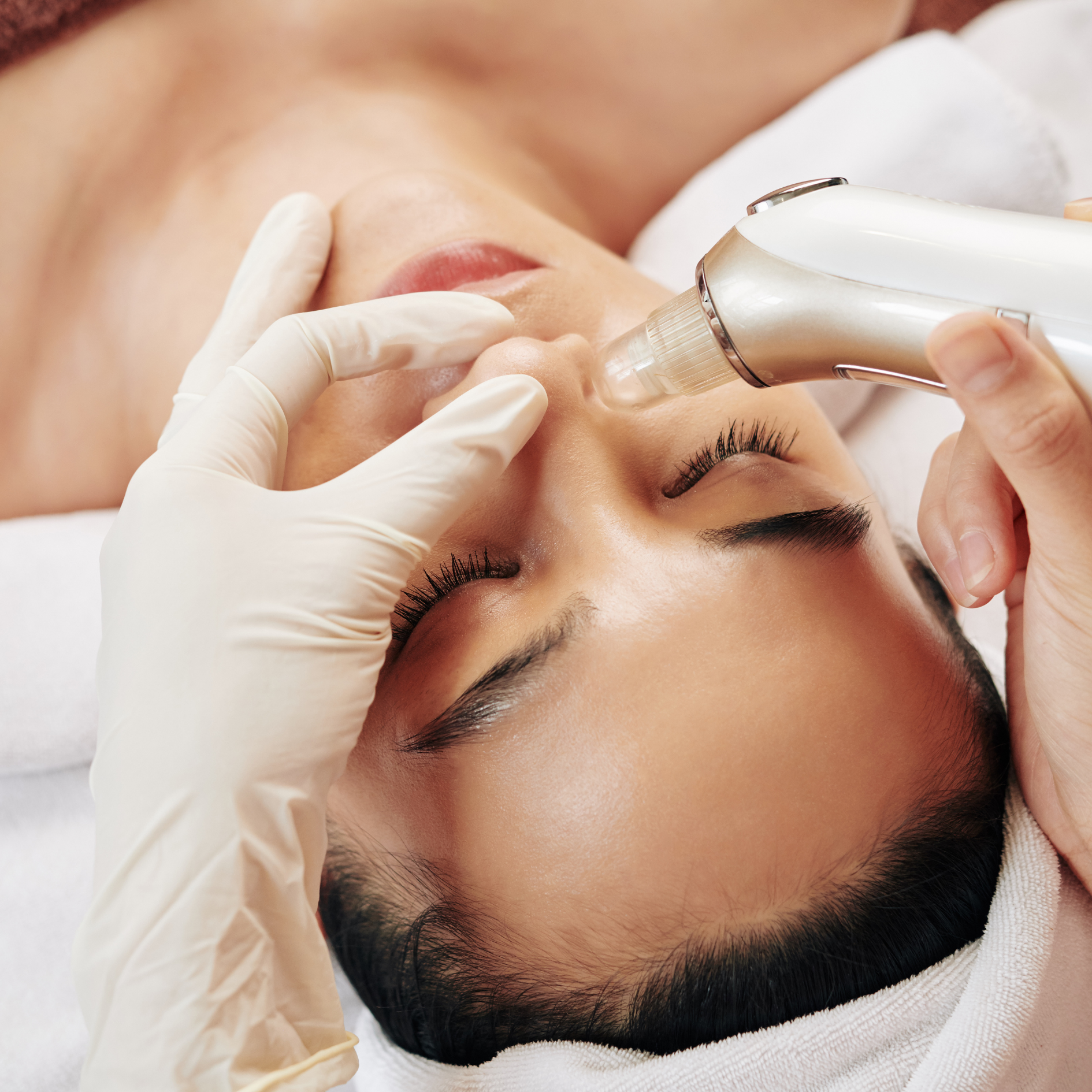PORE REDUCTION